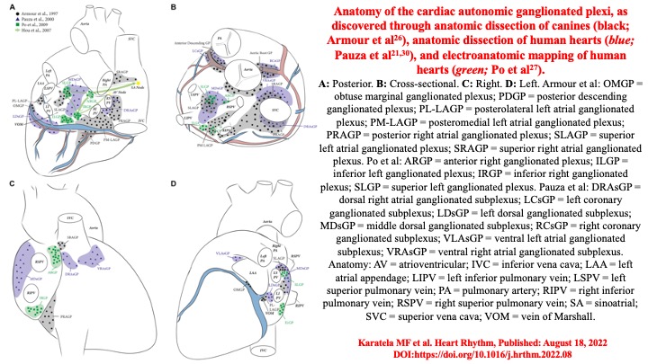 📌 Therapeutic modulation of neurocardiac axis  
👉 for treatment of AF
#afib #CardioTwitter #Review <a href="/DrRoderickTung/">Roderick Tung</a> <a href="/PrashSanders/">Prash Sanders</a> <a href="/MDTolgaAksu/">Tolga Aksu, MD</a> <a href="/shivkumarmd/">Kalyanam Shivkumar MD PhD</a> <a href="/JonPicciniSr/">Jonathan Piccini, MD, MHS</a> <a href="/CarlChiefCard/">Carlos A Morillo</a> <a href="/DhirajGuptaBHRS/">Prof Dhiraj Gupta</a> <a href="/drrakeshg1/">Rakesh Gopinath</a> <a href="/drjohnm/">John Mandrola, MD</a> <a href="/DrJasonAndrade/">Jason Andrade</a> <a href="/jczerpa/">JC ZERPA</a> <a href="/JagSinghMD/">Jag Singh</a> <a href="/netta_doc/">JK Han MD</a> <a href="/EJSMD/">Edward J Schloss MD</a>