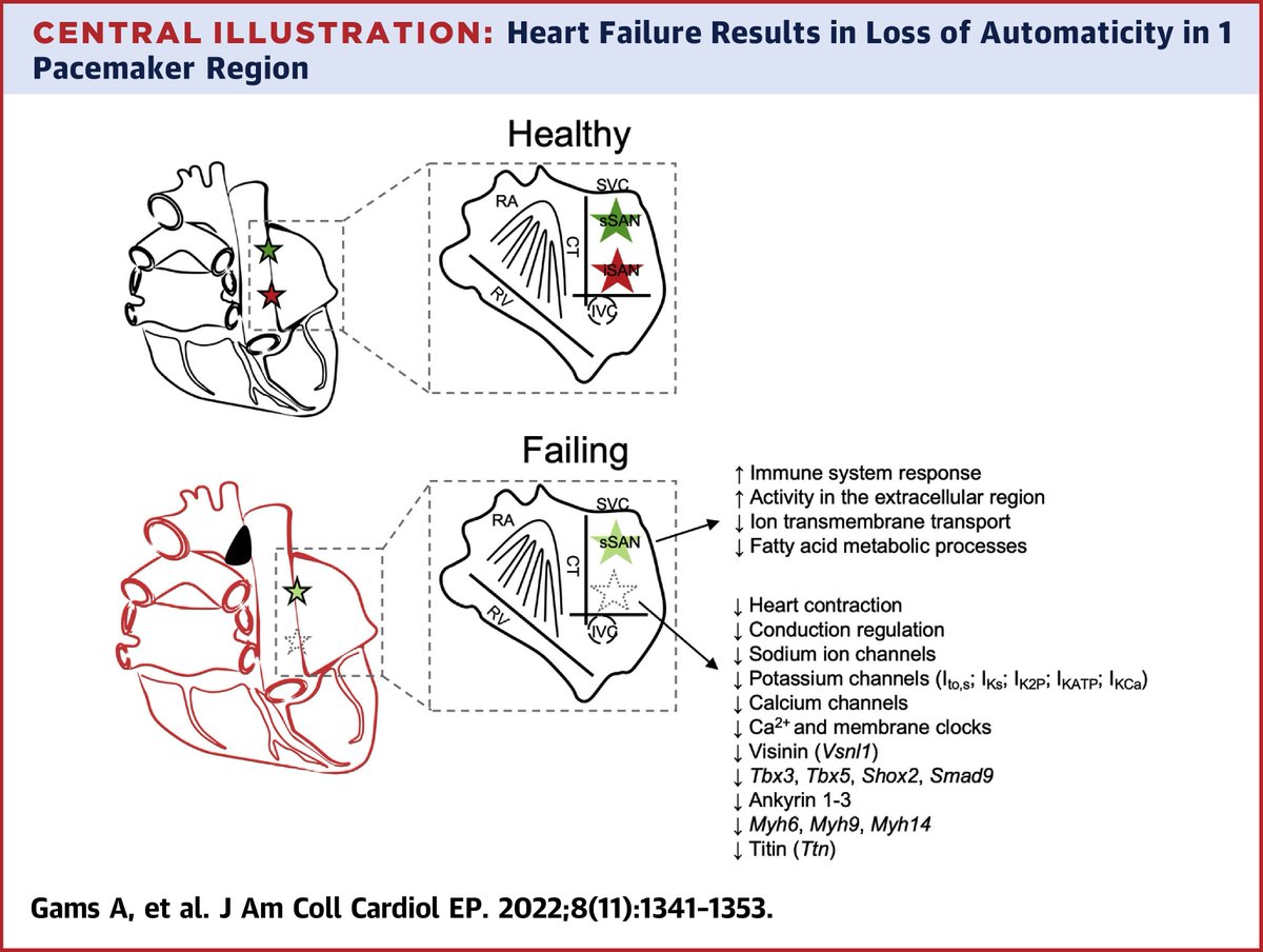 JACCJournals's tweet photo. Did you know that the mammalian heart has superior &amp; inferior SA nodes? During #heartfailure, the inferior SA node is *silenced*. Read how authors found pathways responsible for SA node silencing: https://t.co/Hlne5yKaU0

#JACCCEP #EPeeps #cvHCM #CardioTwitter @AnnaGams https://t.co/Td40ZGSBG8