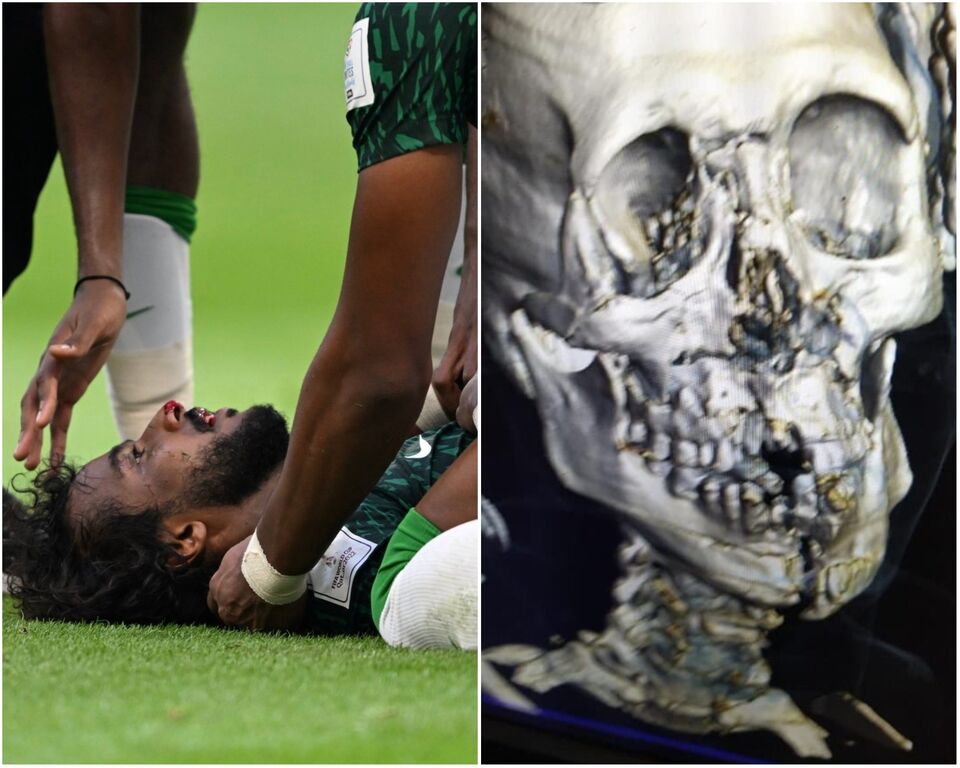 Dubix 💛 tweet media