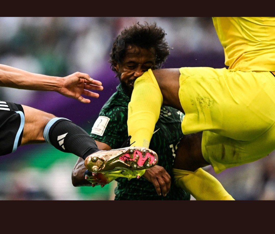 الله يشافيك ويعافيك يارب ياسر الشهراني🇸🇦