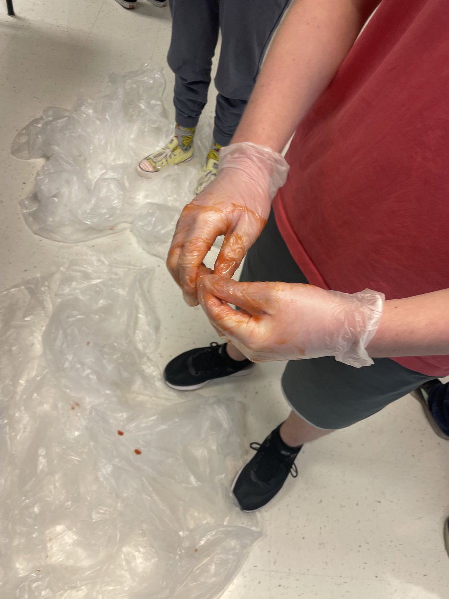 More wound care practice in Sports Medicine. They are learning how to wear gloves and remove them when contaminated with blood. They properly debrided tomatoes that had "dirt" in them to represent a wound. Then learned how to close a wound with steri-strips. #WoundCare