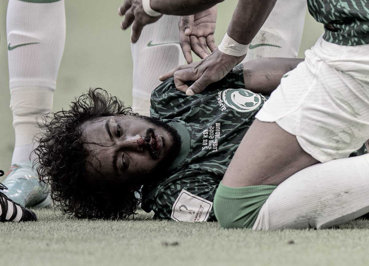 RR0_11's tweet photo. الله يشفي ويعافي ياسر ويرجعه لنا سالم غانم فرحتنا ناقصه والله بسبب اللي صار له 💔
 #ياسر_الشهراني https://t.co/scZ65Bzl8k