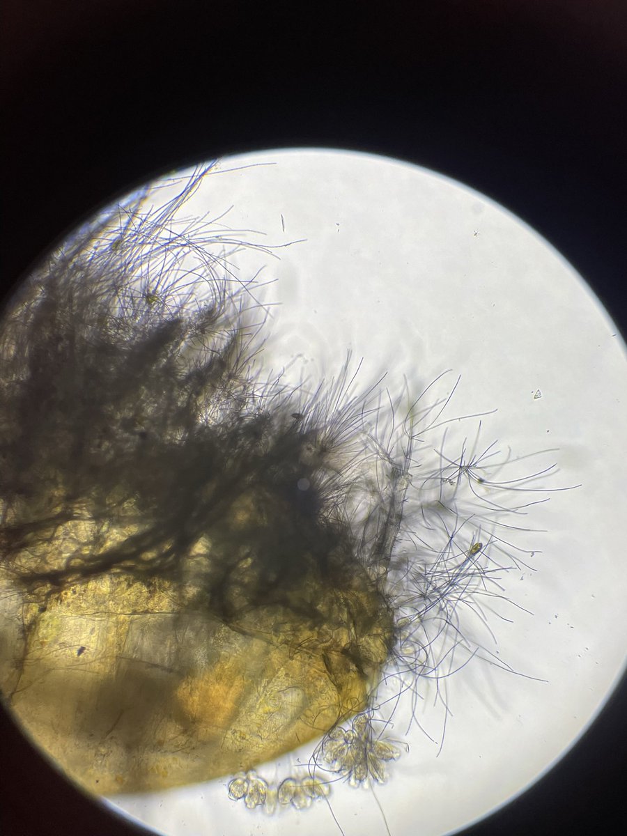 MeisingerRene's tweet photo. @jam_and_germs @JourneyToMicro I can imagine! As nice as finding new stuff: In the same sample I found these very infested copepods. However I have no idea what it could be. Do you maybe have an idea @jam_and_germs ? https://t.co/4IEtFsB40z