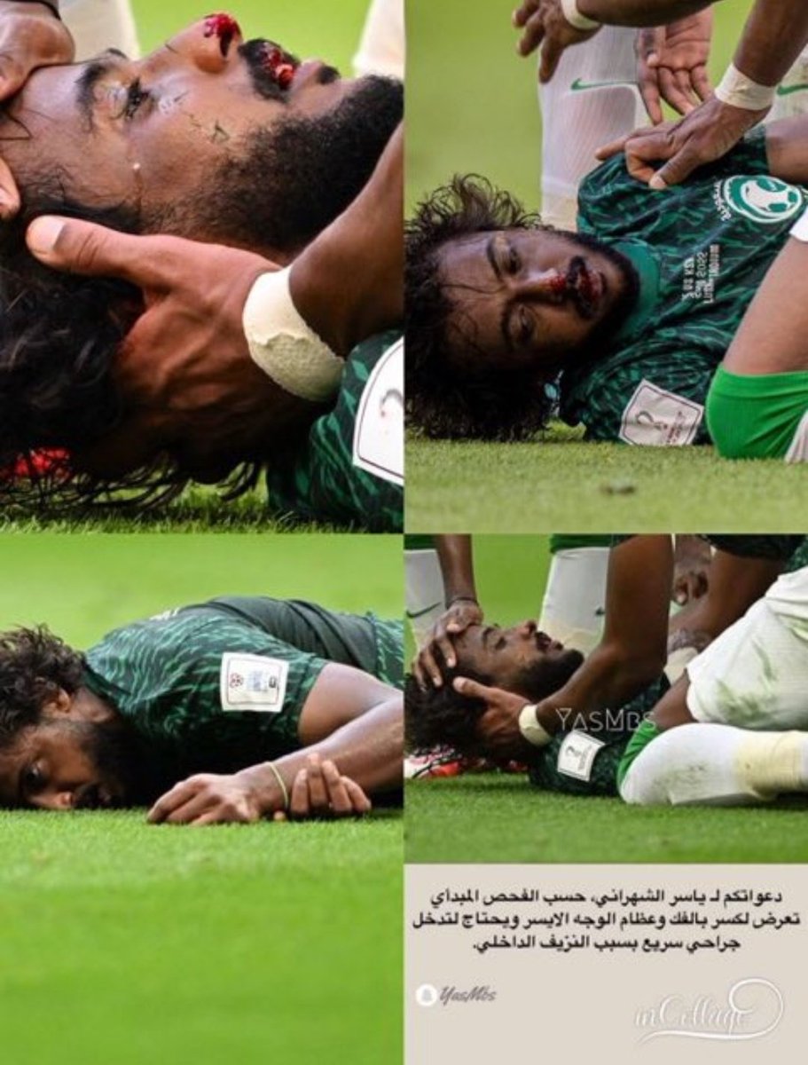 جعلك العافيه وربي يشفيك وترجع يا بطل، أكثر لاعب معجب بلعبه واسلوبه وأخلاقه وهداوته في الملعب، لاعب صامت بس إبداعه ينطق ان شاء الله يرجع أقوى.. #ياسر_الشهراني