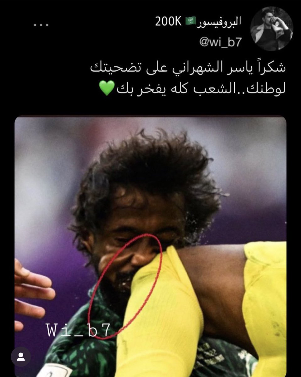 ماتشوف شر ي بطل 💚