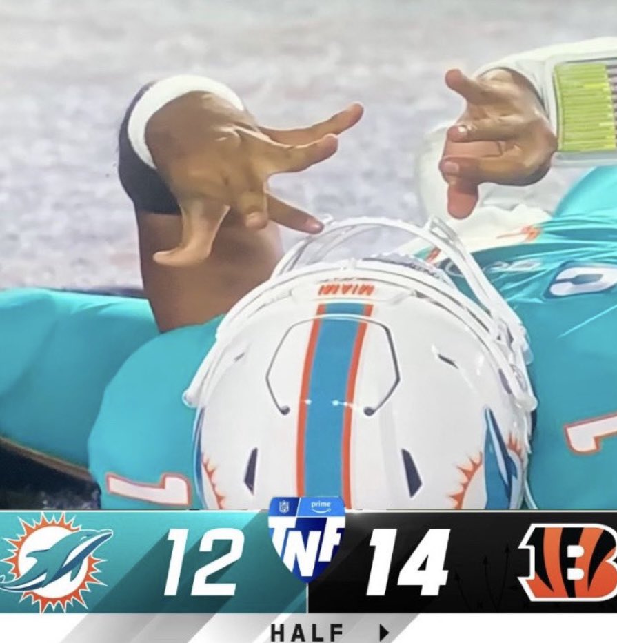 zerodarkperky's tweet photo. @guudvibesssonly @Coledrigeszn @NFL Ratio + ur qb got mash potatoes for brains https://t.co/5ZhAMffSs2