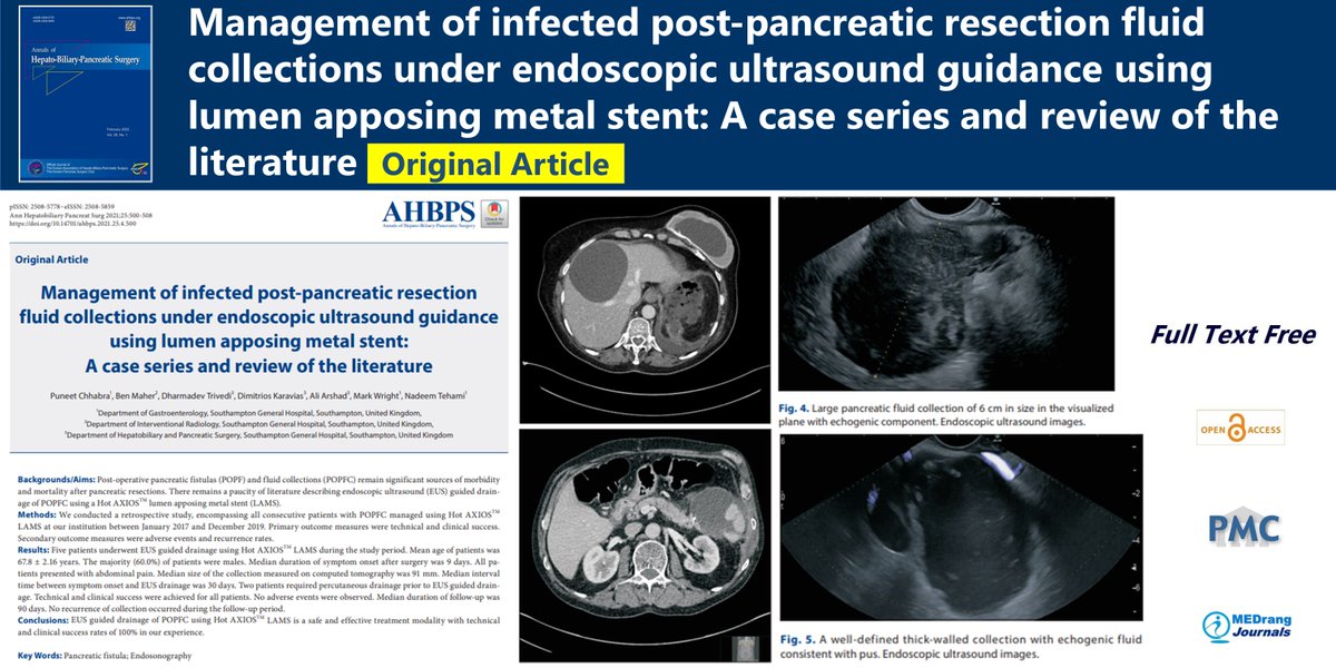 Management of infected post-pancreatic resection fluid collections under endoscopic ultrasound guidance using lumen apposing metal stent: A case series and review of the literature
🌷doi.org/10.14701/ahbps…
 2021 Nov;25(4)Puneet Chhabra
#Pancreatic_fistula #Endosonography