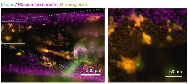 preLights (@prelights) on Twitter photo It's #BiofilmWeek! π¦
<a href="/sne_kad/">Snehal Kadam, PhD</a> posted a relevant #preLight earlier this year about a #preprint from <a href="/tamara_rossy/">Tamara Rossy</a> <a href="/alexpersat/">Alex Persat</a> & colleagues describing a new in vitro model to study the association between P. aeruginosa and mucus.
prelights.biologists.com/highlights/pseβ¦
#BiofilmAware #Biofilms It's #BiofilmWeek! π¦
<a href="/sne_kad/">Snehal Kadam, PhD</a> posted a relevant #preLight earlier this year about a #preprint from <a href="/tamara_rossy/">Tamara Rossy</a> <a href="/alexpersat/">Alex Persat</a> & colleagues describing a new in vitro model to study the association between P. aeruginosa and mucus.
prelights.biologists.com/highlights/pseβ¦
#BiofilmAware #Biofilms