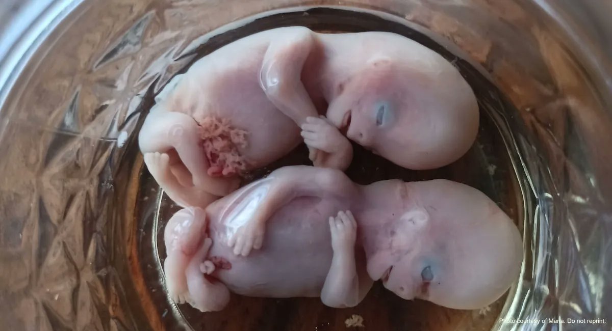 Live Action News tweet media