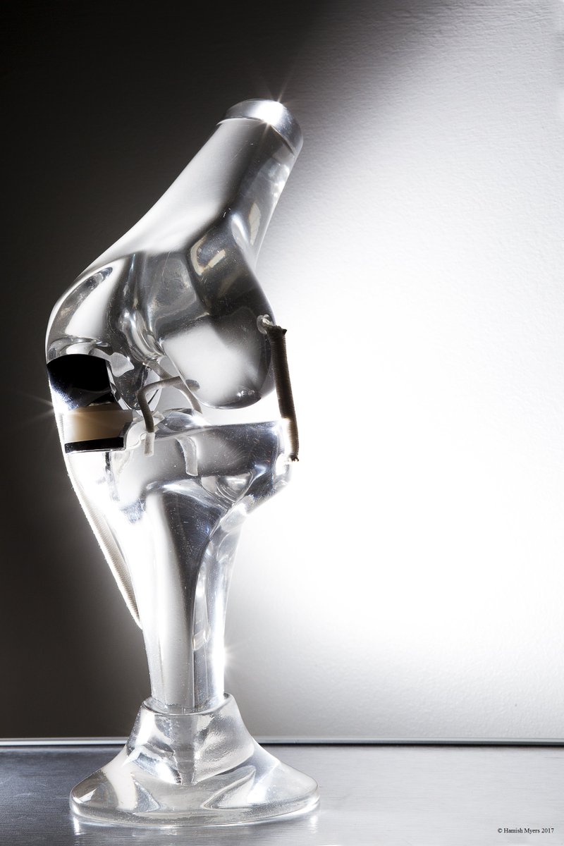 OOEC (@ooec_oxford) on Twitter photo We are at a fantastic 98 responses to <a href="/LachieArthur/">Lachlan Arthur</a>'s survey on #OxfordKnee instrumentation and would love to reach 100. If you do, or have done, the Oxford Knee and have a few minutes to help we would be incredibly grateful bit.ly/OxfordUniSurvey
#ThankYou #orthotwitter We are at a fantastic 98 responses to <a href="/LachieArthur/">Lachlan Arthur</a>'s survey on #OxfordKnee instrumentation and would love to reach 100. If you do, or have done, the Oxford Knee and have a few minutes to help we would be incredibly grateful bit.ly/OxfordUniSurvey
#ThankYou #orthotwitter
