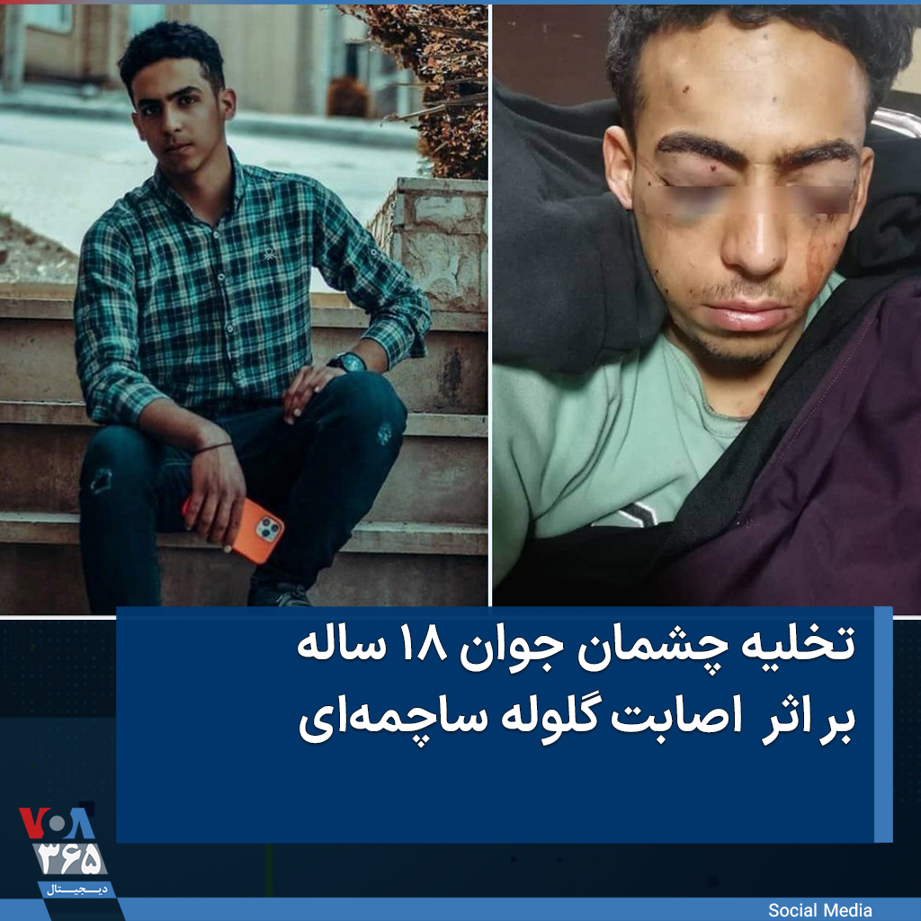 VOAfarsi's tweet photo. شبکه حقوق بشر کردستان با انتشار تصویری از #پارسا_قبادی از تخلیه هر دو چشم او بر اثر  اصابت #گلوله_ساچمه‌ای خبر داد. https://t.co/jYbMLrWzOm