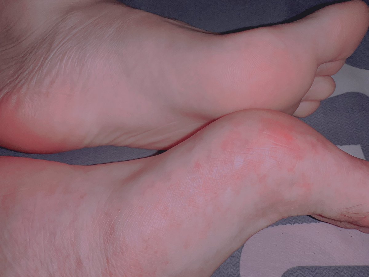 更个jio🦶吧

#反差 #重口 #母狗 #骚逼 #射屏 #文爱 #后入 #大学生 #姐姐 #女王 #母畜 #羞辱 #调教 #颜射 #闺蜜 #同事 #绿帽 #绿奴 #分享  #女友 #口交 #射精 #性瘾 #淫水 #叫床 #足交 ＃黑丝 #聊骚 #臭脚