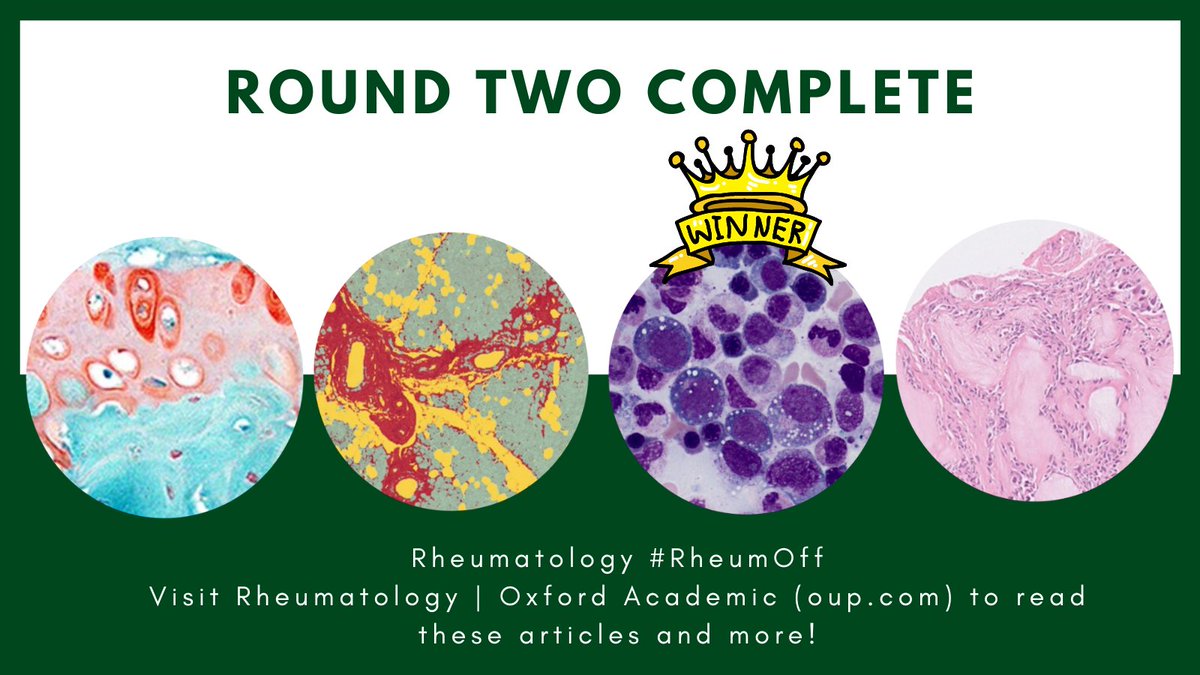 RheumJnl's tweet photo. Round Two Winner! 🏆 #RheumOff
Bone marrow aspirate from patient with VEXAS syndrome https://t.co/gcOmpBt4F0 by @Ertugrul_cagri @petercgrayson et al will be one of three on the cover of Rheumatology Volume 62! ⭐
👉 Tune in for round three later today! https://t.co/LBUvBOb9t0