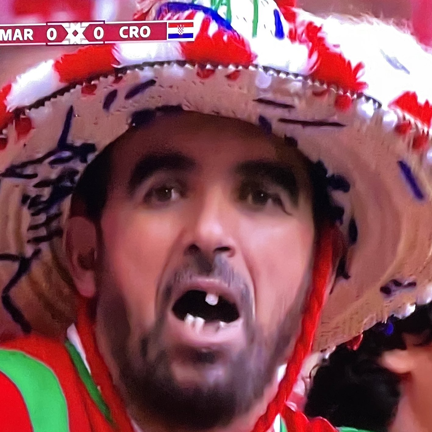 Barstool Football on Twitter "Spent the dentist money on a trip to