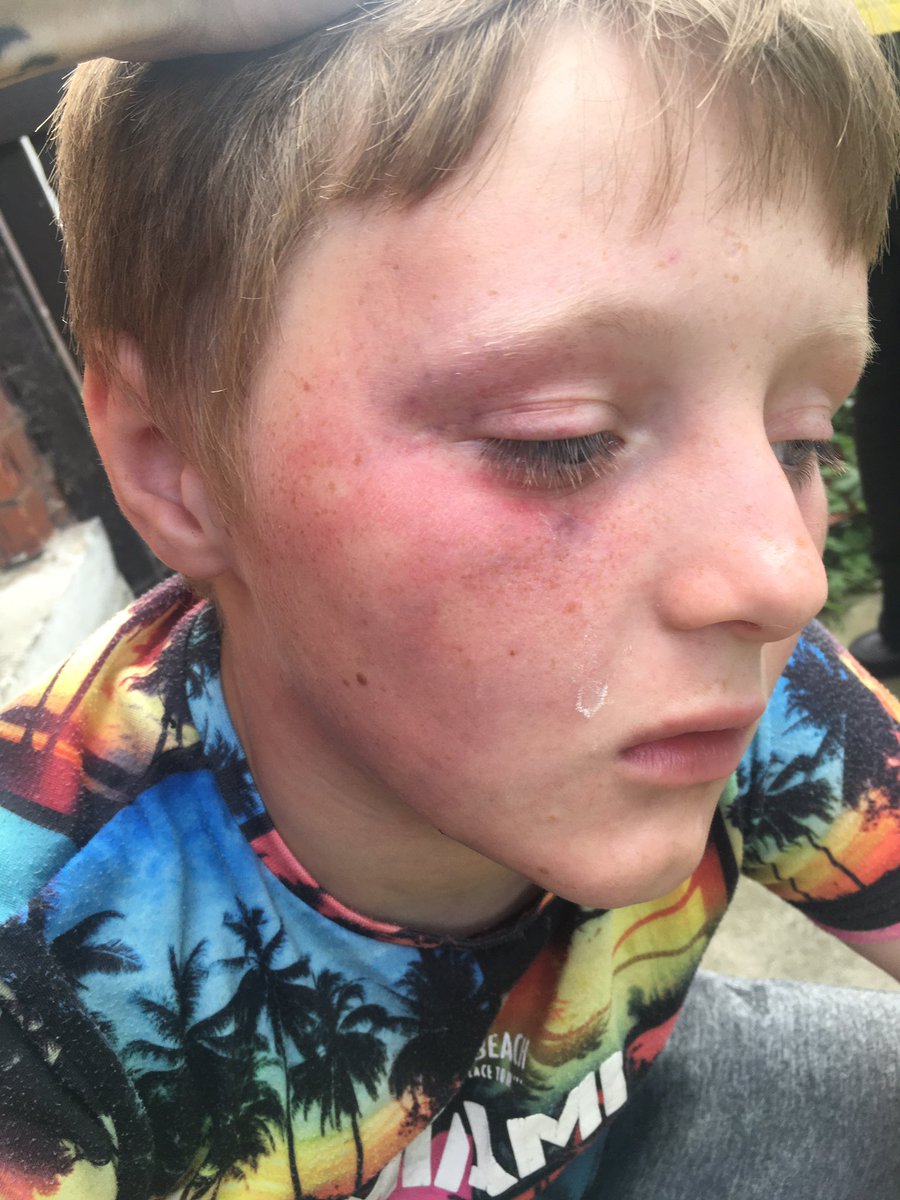 ChallinorKym's tweet photo. @UmarKamani  #PLTwishes  @OfficialPLT  I would love £500 for my boys my youngest get a broken cheek bone of his dad now my kids aren’t aloud to see him and I’m really struggling this year with losing my Job  thank you and merry Christmas xz https://t.co/ni78ZHBtDw