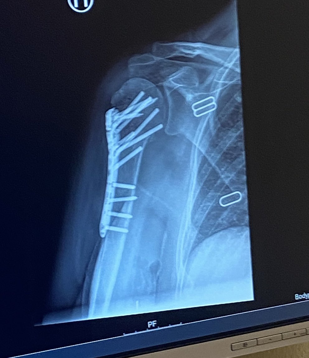 Beate Husa tweet media