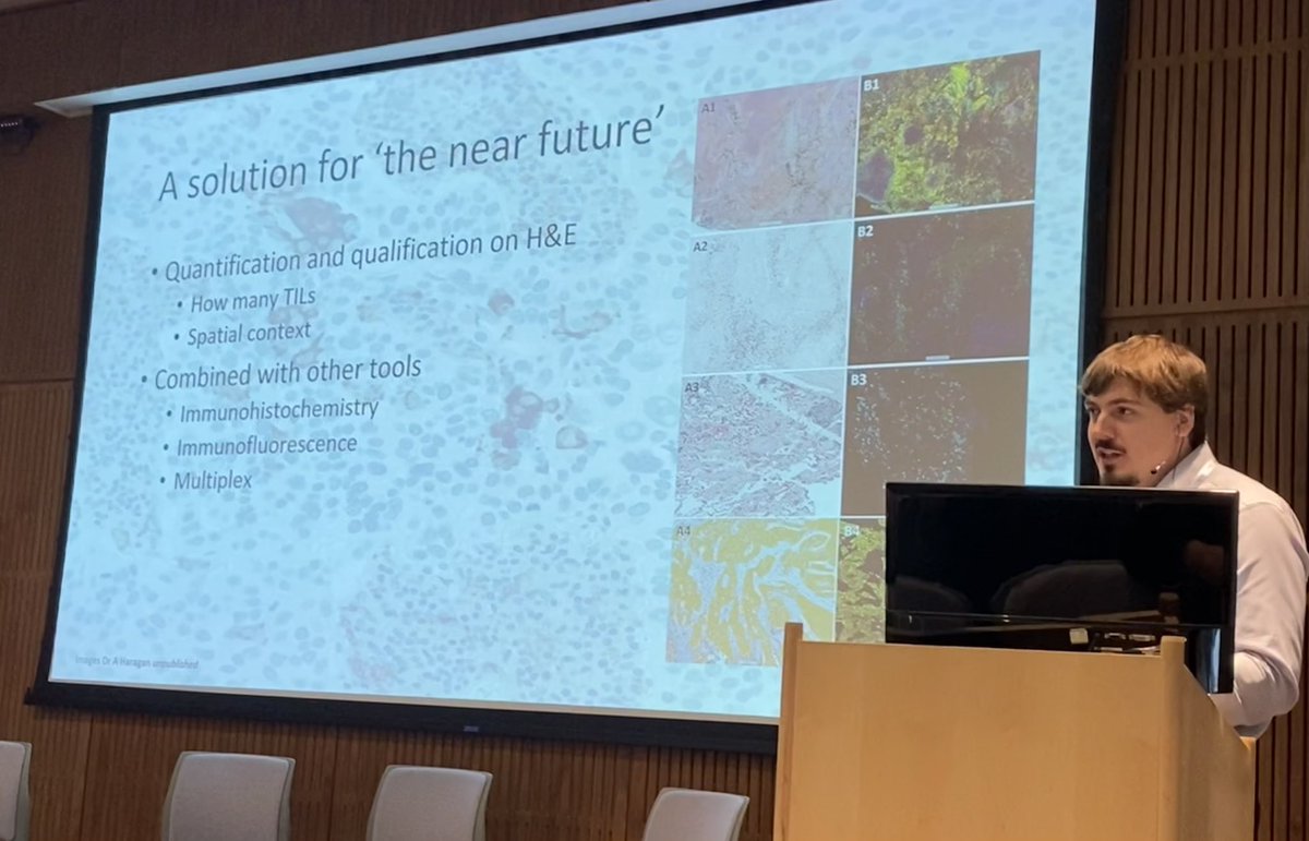 SarahCoupland3's tweet photo. Dr Alex Haragan (Liverpool) speaking about the application of AI on lung cancer immunohistochemistry at the Roche Digital Pathology and AI symposium today @rcpath #rcpath https://t.co/P1cNhoPOhd