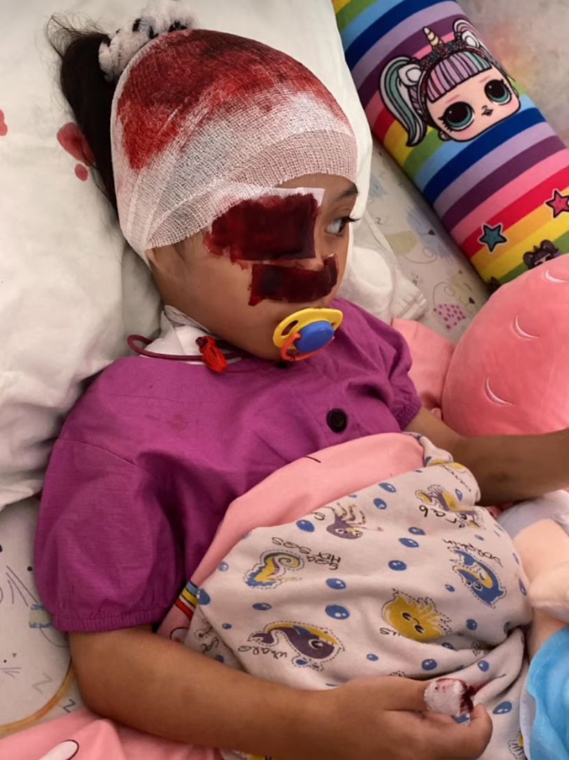 🪄TWITTER PLEASE DO UR MAGIC🪄
Namaku Lula, umurku 4thn. Aku adalah pejuang Bernards Soulier Syndrome,kelainan genetik turunan dgn ketidakmampuan tubuh membekukan darah. Sekarang sedang berjuang u/ sembuh stlh 4 saudaraku meninggal akibat penyakit yg sama-