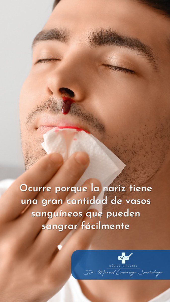 DrLavariega's tweet photo. Las hemorragias nasales pueden tener causas que no se deben a una enfermedad subyacente. Por ejemplo, sequedad nasal, meterse el dedo en la nariz o lesiones https://t.co/aIiIqOpvAX
