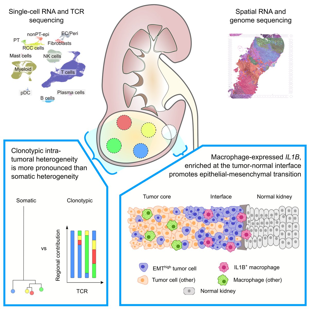 I am pleased to announce our latest paper.

We report results from single cell RNA and TCR sequencing, alongside spatial RNA and genome sequencing across different regions of kidney cancers:

cell.com/cancer-cell/fu…