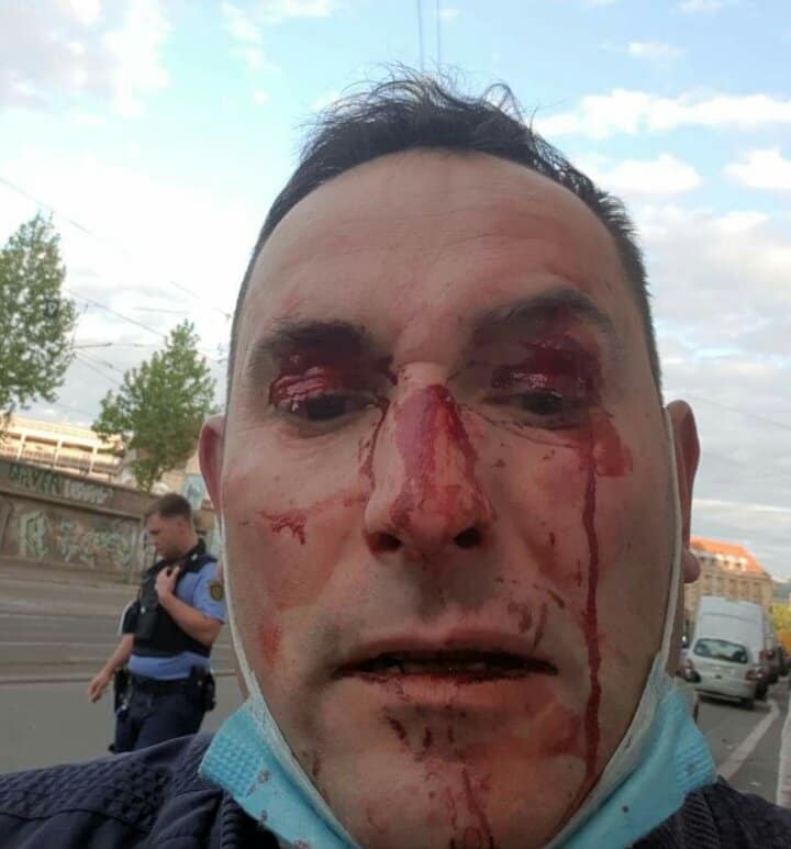 ourstreets_le's tweet photo. CN Blut
Von Simon,der in der Vergangenheit als Redner bei unterschiedlichen rechten Versammlungen auftrat,war zuletzt nicht mehr viel zu hören.Ob dies an seiner letzten mit Begegnung mit Leipziger Antifas im Nachgang einer Kundgebung #le1205 liegt,bleibt zumindest möglich. 11/x https://t.co/LIE2gniSGN