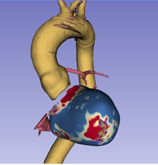 Oncología radioterápica HUPH tweet media