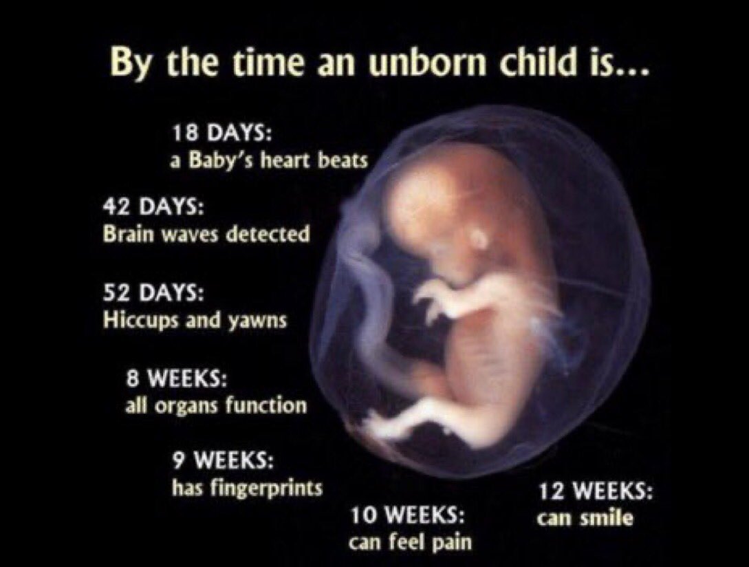 I AM PROLIFE @lgtjs @imt45p @raderld @TeePal2 @RDog861 @PriamtheB @DixiDarlen @laura_7771 @PaulaRed62 @Holmez1922 @Corgi_MAGA @tomlin_francis @MuskFreedom @TJDOGMANR2 @helen44767171 @StaceytheGhost @pamhuntersmom @AugustusMcRae1 @GartersGunsNGod @emma6USA 🦅