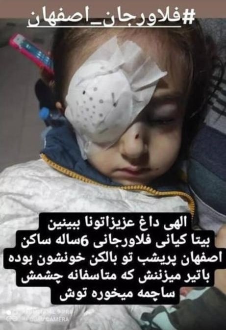 iranhrs99's tweet photo. #فوری 

شلیک به چشم دختر ۶ ساله

بر اساس تصویر منتشر شده در شبکه های اجتماعی #بیتا_کیانی کودک ۶ ساله در فلاورجان #اصفهان درحالیکه در بالکن خانه بوده هدف گلوله قرار گرفته و چشمش ساچمه خورده است.

#مهسا_امینی https://t.co/peXPPcDSYy