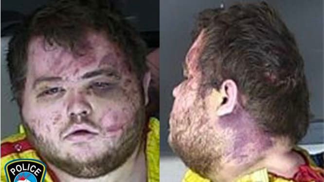 OccupyDemocrats's tweet photo. BREAKING: This is what the Q Club shooting suspect looked like after the army vet and the trans woman were finished with him. The MAGA terrorist's booking photo was just released by the Colorado Springs Police Department. https://t.co/dChnryquu9