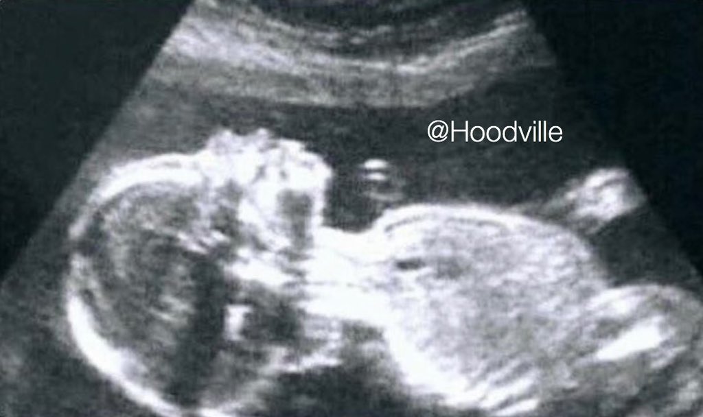 Her: this 🐱 gon f***k yo life up

Me: u lying

Couple months later: