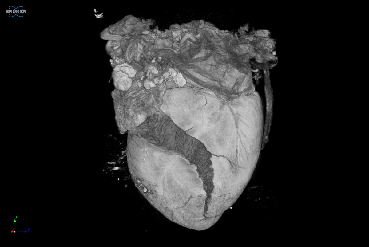 A/Prof Jo James (@drjojames) on Twitter photo Congrats to <a href="/AnanditaU/">Anandita Umapathy</a> for taking out top place in the <a href="/FMHS_UoA/">Faculty of Medical and Health Sciences UoA</a> BIRU imaging βvisualisation and analysisβ category for βWhat becomes of the broken heartedβ. Amazing microCT imaging of the fetal heart, and bringing home theπΎ for #jameslab ππ Congrats to <a href="/AnanditaU/">Anandita Umapathy</a> for taking out top place in the <a href="/FMHS_UoA/">Faculty of Medical and Health Sciences UoA</a> BIRU imaging βvisualisation and analysisβ category for βWhat becomes of the broken heartedβ. Amazing microCT imaging of the fetal heart, and bringing home theπΎ for #jameslab ππ