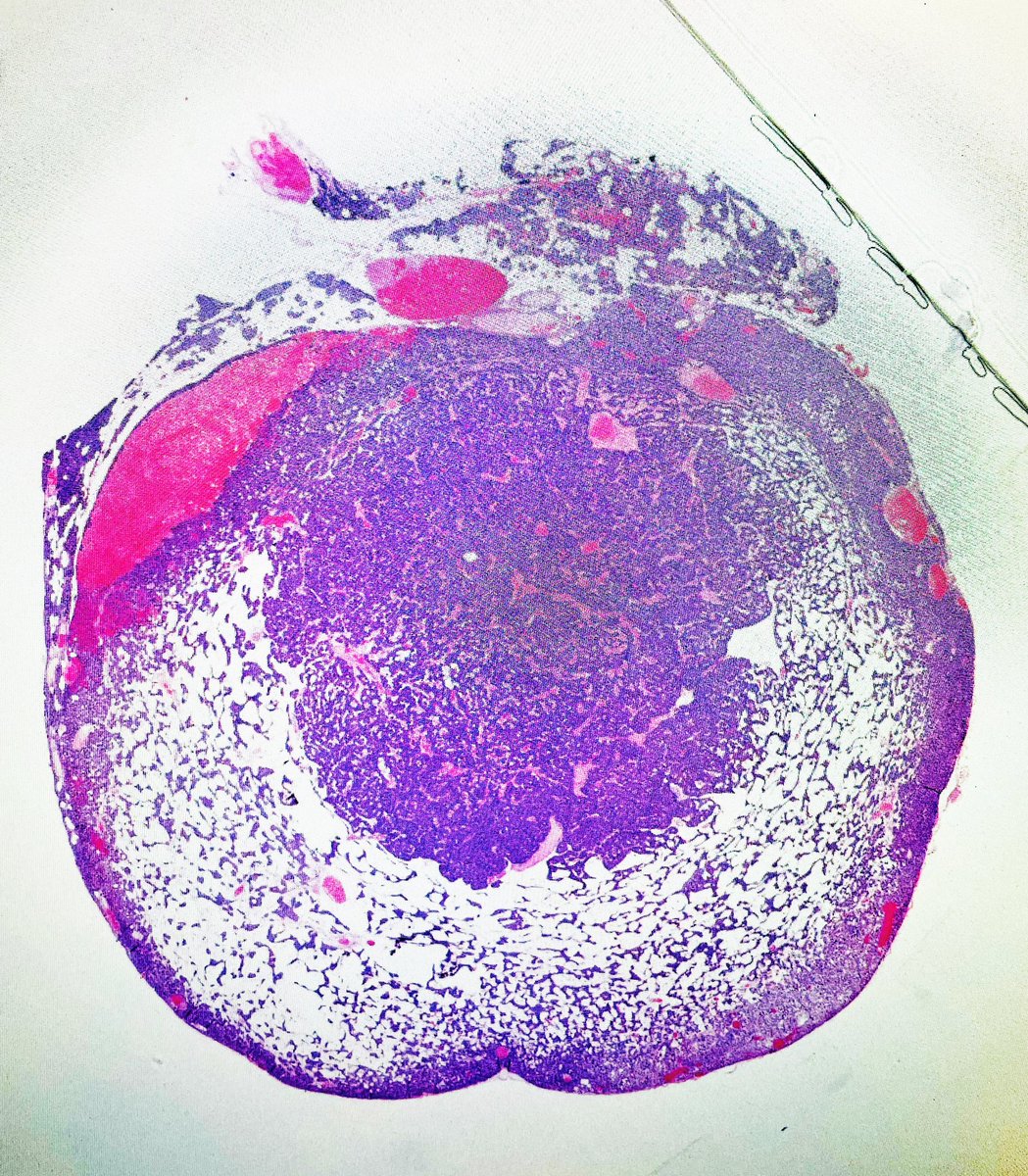 ”We have reason to believe that your cell phone had something to do with the development of your hyperparathyroidism”