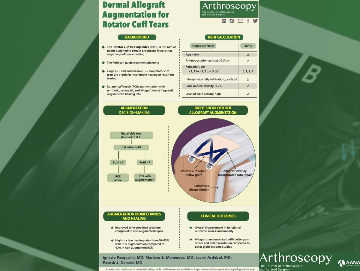 This month's infographic on dermal allograft augmentation of rotator cuff repairs. ow.ly/SMvl50LJ4WR @PatrickDenardMD