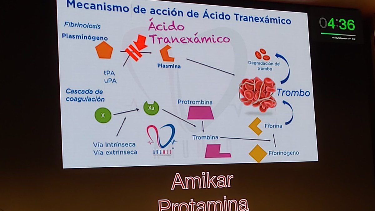 <a href="/SEMES_/">SEMES</a> Reanimación por tromboelastografía de la mano de Marco Umaña Ramírez. Que será este palabro? #CONCEPTOS2022