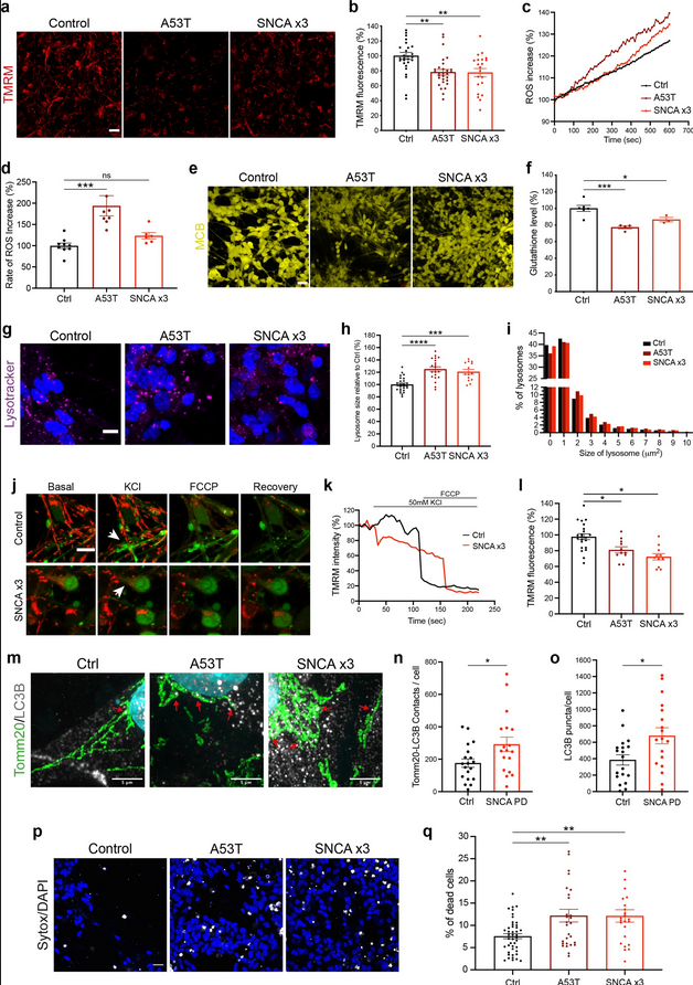 The Science of Parkinson's tweet media