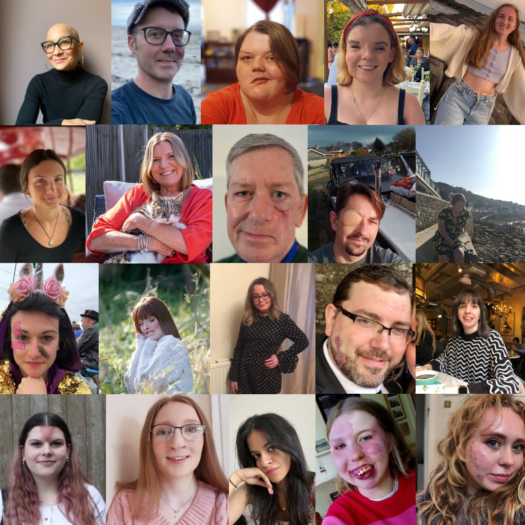 We’re proud to welcome our latest group of amazing campaigners, who will join our current cohort to raise awareness about what life is like with a visible difference.
Here's what makes them most excited about becoming a Changing Faces campaigner:⤵️

bit.ly/3ieFBJa