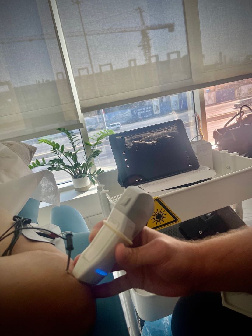 holisticppc's tweet photo. Percutaneous electrolysis therapy #Physiotherapy 
#العلاج_الطبيعي https://t.co/HVgIj4uHcJ
