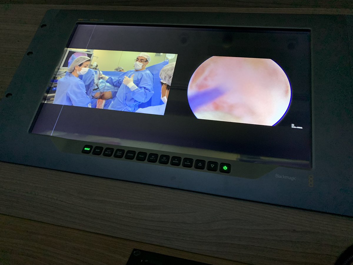 Nicolas Rotholtz (@nicorotholtz) on Twitter photo Colorectal Course at <a href="/ircadamerica/">IRCAD América Latina</a> already started. Life surgery A pleasure to be invited <a href="/luisromagnolo/">Luis Gustavo</a> <a href="/armando_melani/">Armando Melani</a> <a href="/proctoramon/">Ramon Mendes</a> <a href="/IrcadFrance/">IrcadFrance</a> <a href="/JMarescauxIrcad/">Jacques Marescaux</a> Colorectal Course at <a href="/ircadamerica/">IRCAD América Latina</a> already started. Life surgery A pleasure to be invited <a href="/luisromagnolo/">Luis Gustavo</a> <a href="/armando_melani/">Armando Melani</a> <a href="/proctoramon/">Ramon Mendes</a> <a href="/IrcadFrance/">IrcadFrance</a> <a href="/JMarescauxIrcad/">Jacques Marescaux</a>