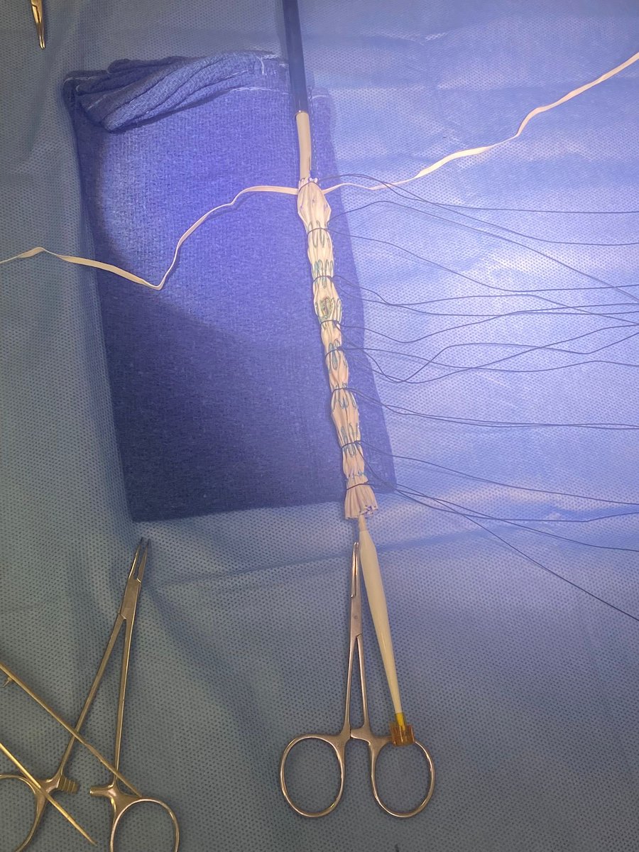 Mark Archie MD (@markarchie10) on Twitter photo Arts and crafts with the <a href="/HarborUCLA_VS/">Harbor-UCLA Vascular Surgery</a> crew <a href="/Dr_NikhilKansal/">Nikhil Kansal</a> <a href="/MikaylaHurwitz/">Mikayla Hurwitz, MD</a> <a href="/drdevirgilio/">Christian de Virgilio MD FACS</a> Arts and crafts with the <a href="/HarborUCLA_VS/">Harbor-UCLA Vascular Surgery</a> crew <a href="/Dr_NikhilKansal/">Nikhil Kansal</a> <a href="/MikaylaHurwitz/">Mikayla Hurwitz, MD</a> <a href="/drdevirgilio/">Christian de Virgilio MD FACS</a>
