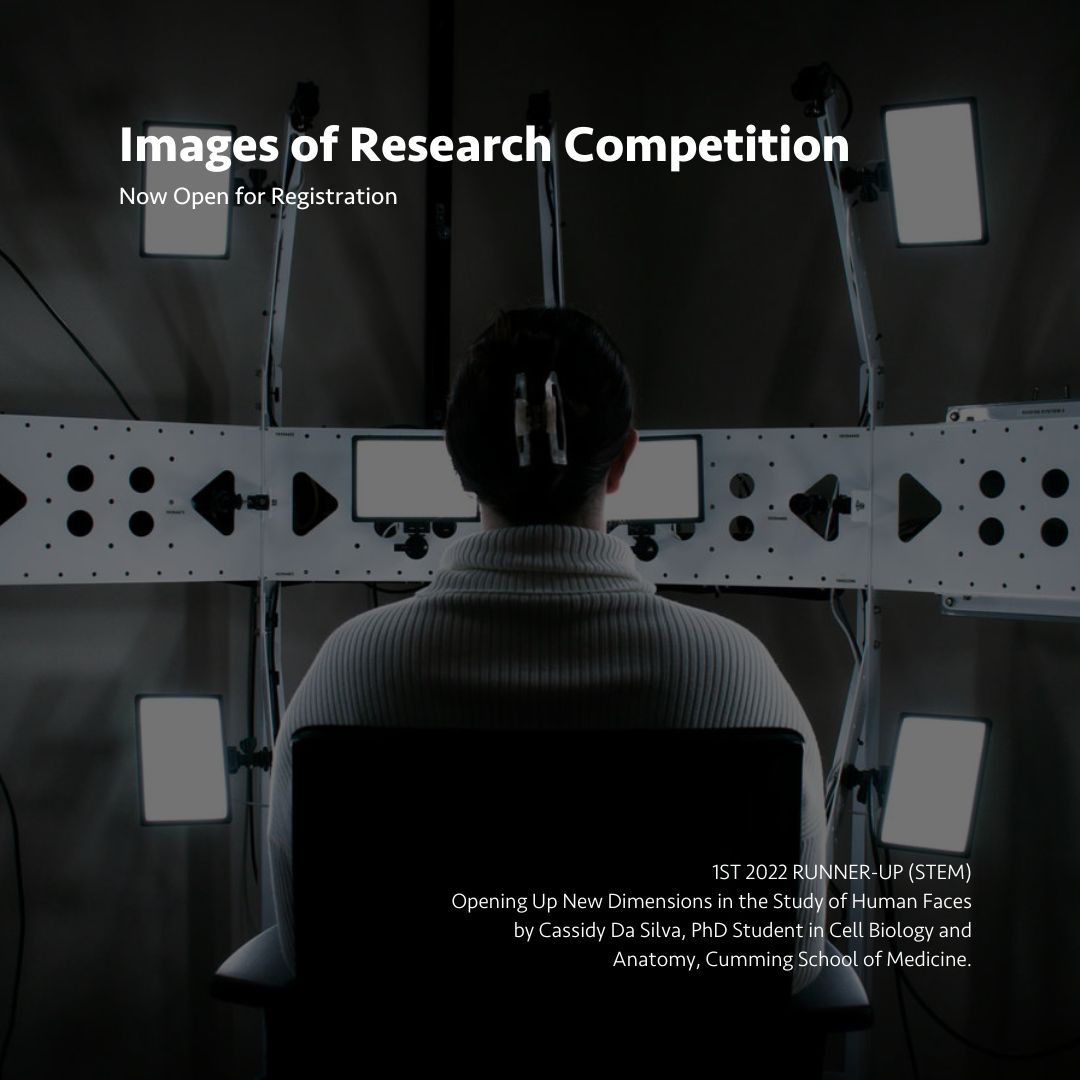 GSACalgary's tweet photo. Use an image to tell a story showcasing your research in the annual Images of Research Competition. The @UCalgaryFGS and GSA invite you to explore new ways of thinking about your research and communicate it to a broad audience.

Learn more here: https://t.co/U9l3pFG3Rx https://t.co/MCsizVf3AT