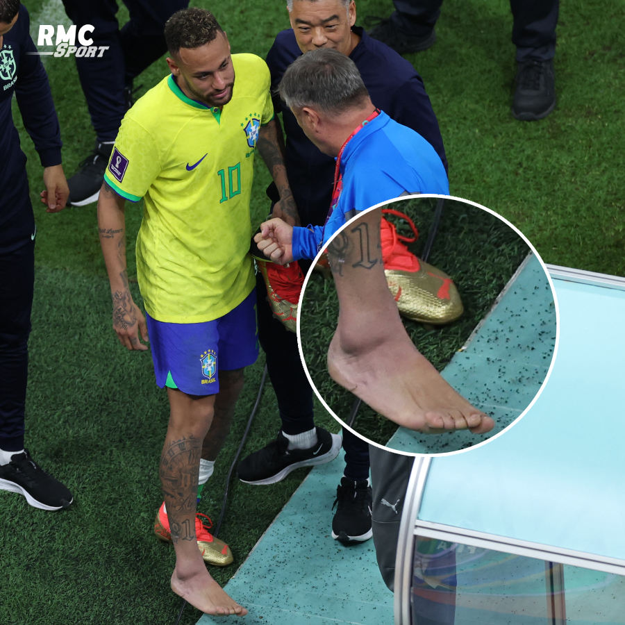 RMCsport's tweet photo. 📸 La cheville de Neymar. https://t.co/Z3vOzaPNoz