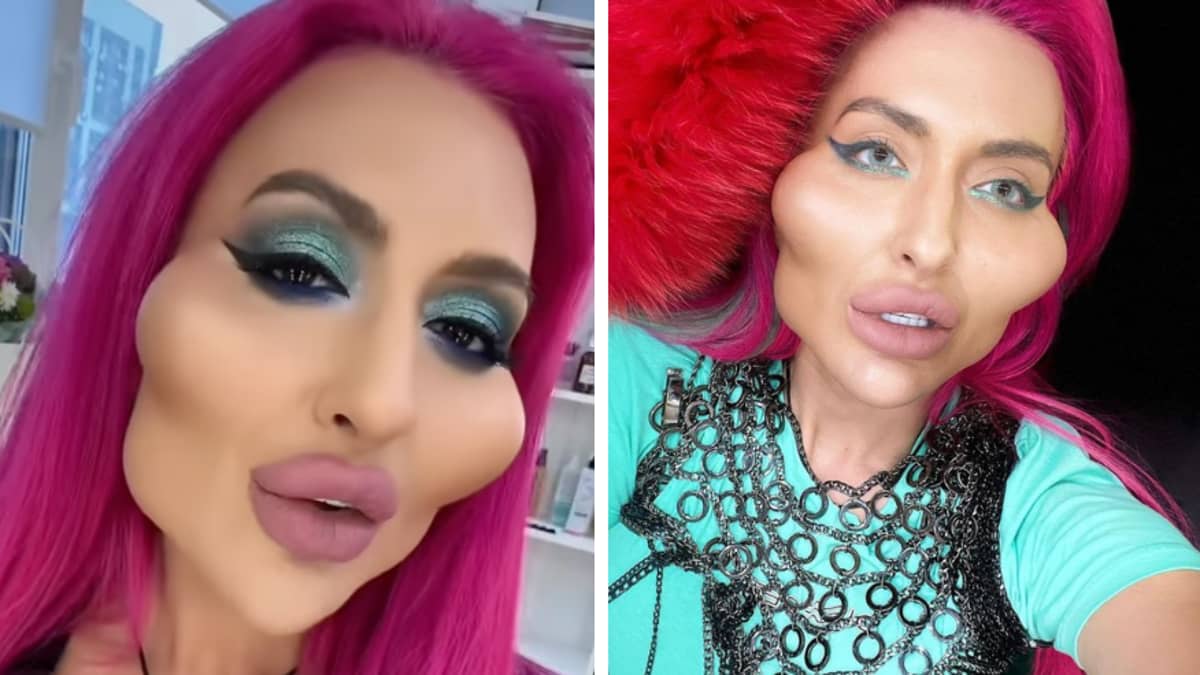 Tyla's tweet photo. 🔔 | Woman with 'world's biggest cheeks' shows what she looked like before surgery 

More below 👇 https://t.co/X2eaHkFpuU