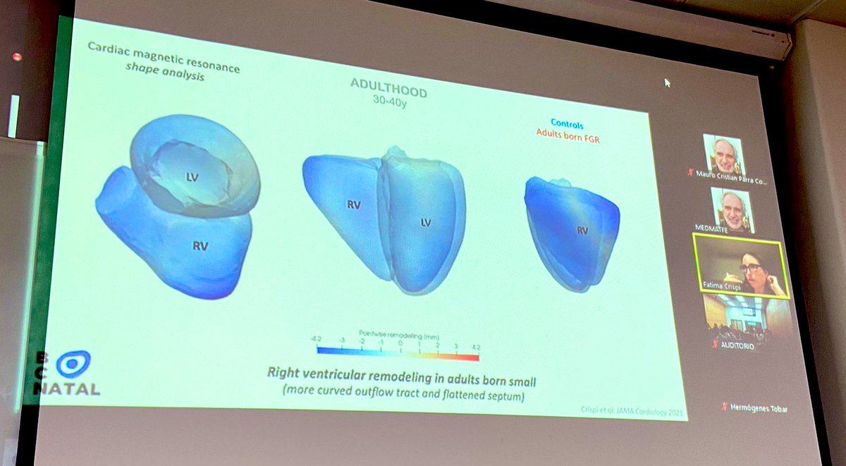 Fatima Crispi (@fatimacrispi) on Twitter photo Un placer conectar con la Universidad de Chile para compartir nuestra experiencia sobre salud cardiovasvular en restricción de crecimiento fetal #CIR #IUGR #heart
Gracias a <a href="/DecanoParra/">MauroParraDecano</a> y <a href="/Alvaro_Sep_M/">Alvaro Sepulveda Martinez, PhD</a> por la invitación Un placer conectar con la Universidad de Chile para compartir nuestra experiencia sobre salud cardiovasvular en restricción de crecimiento fetal #CIR #IUGR #heart
Gracias a <a href="/DecanoParra/">MauroParraDecano</a> y <a href="/Alvaro_Sep_M/">Alvaro Sepulveda Martinez, PhD</a> por la invitación