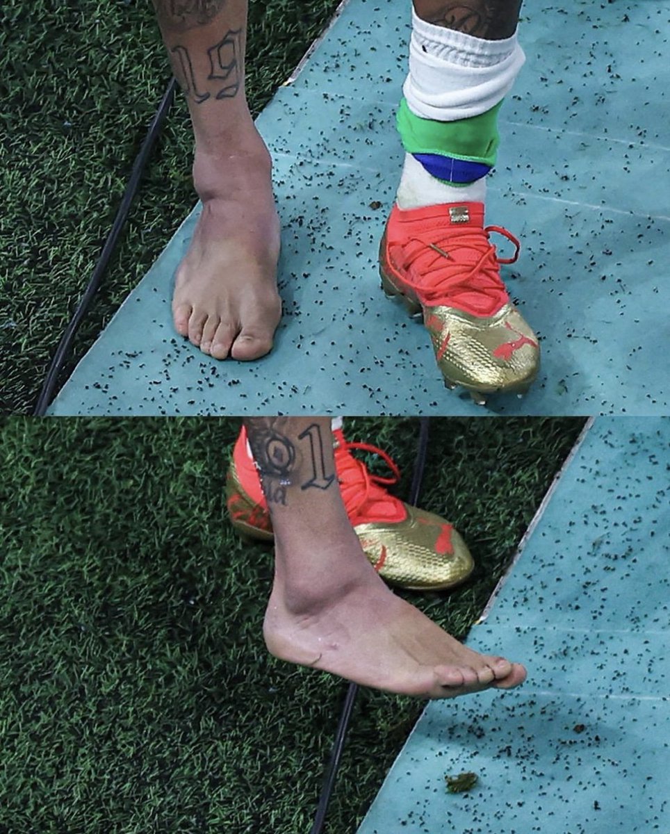 Naija_PR's tweet photo. Neymar’s ankle https://t.co/JQhhWqv5om