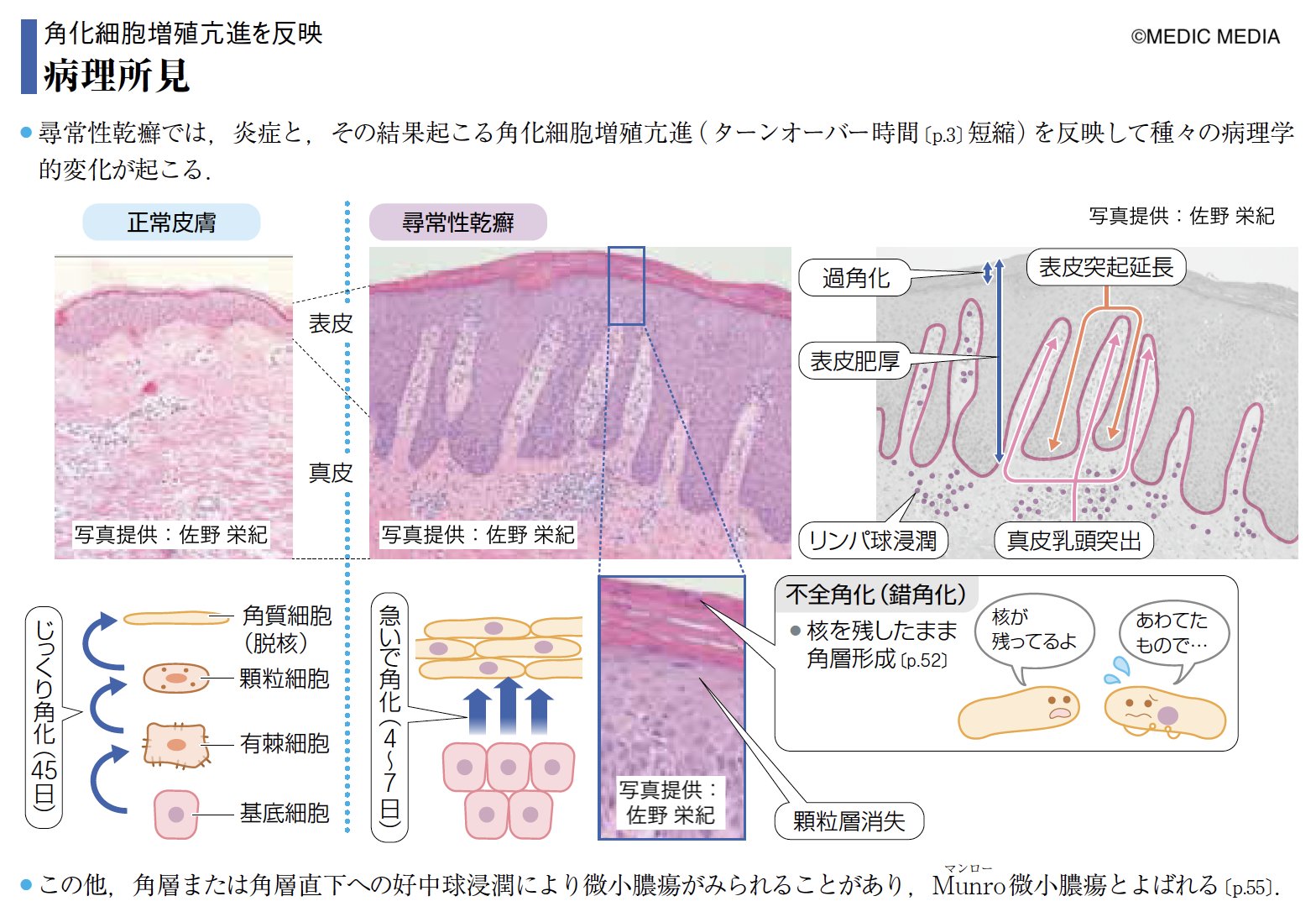 皮膚病理を読む 皮膚病理がみえてくる 皮膚科診療プラクティス3