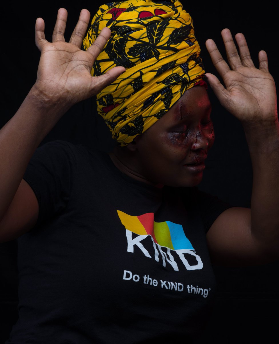 YouthSprint's tweet photo. #SololaNaNurseNisa
La violence physique doit être combattue, elle ne doit plus être considérée comme une question d’ordre privé aidons les femmes à briser le silence.
Dites « bonjour » à l’Infirmière Nurse Nisa sur whatApp au +243827325289 pour plus de conseils.
@MakokiYaMwasi https://t.co/aOCx4MdAFN