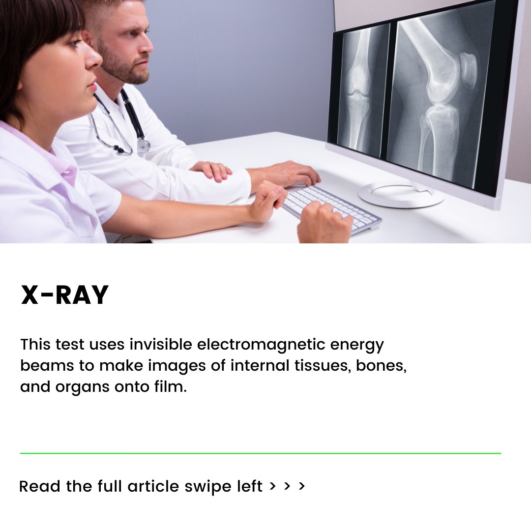 Painhealer8's tweet photo. How are knee problems diagnosed?

In addition to a complete medical history and physical exam, other tests for knee problems may include:

Read more here: 

#arthritis #chronicpain #chronicillness #pain https://t.co/cGihfL6OBU