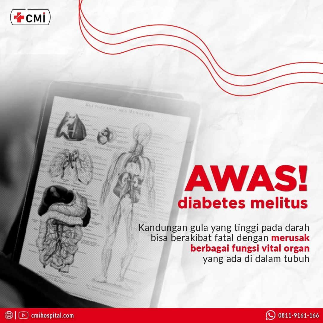 cmihospitals's tweet photo. Selain dikenal sebagai Ibu dari Segala Penyakit karena menimbulkan berbagai macam komplikasi, Diabetes juga dikenal sebagai The Sillent Killer. 

#komplikasidiabetes #silentkiller #diabetessembuh #rumahsakitdiabetes #obatdiabetes #pengobatandiabetes #solusidiabetes https://t.co/eUW5QZzEP6