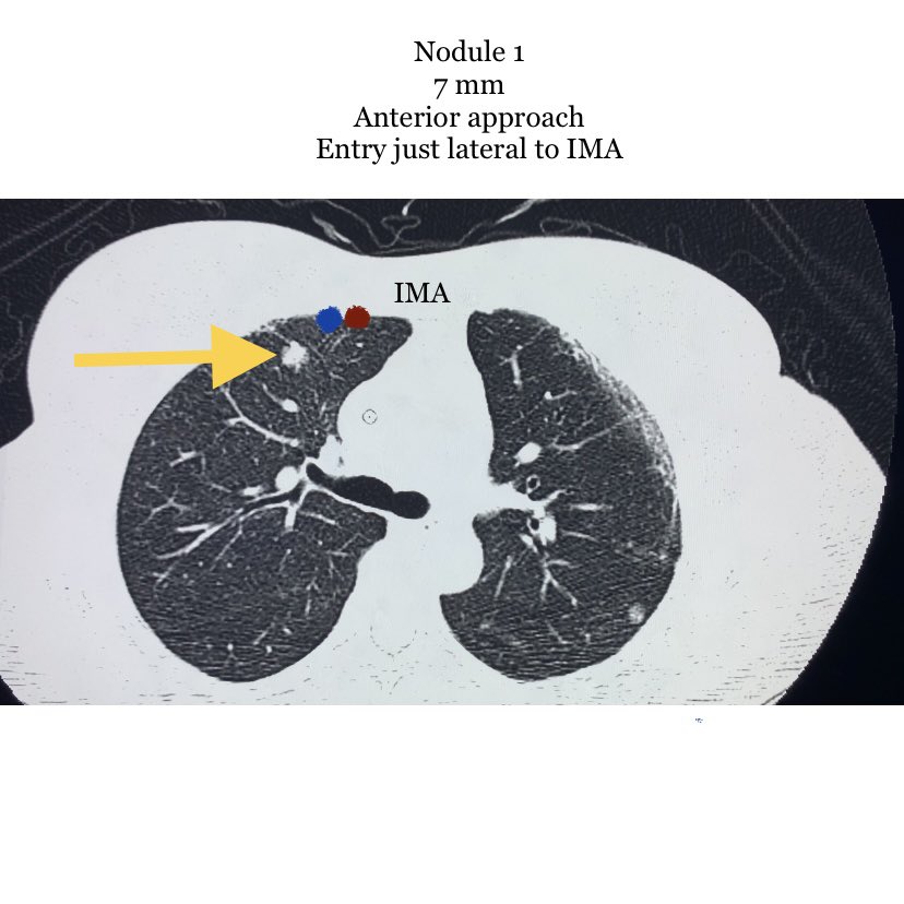Endovascular Rounds tweet media