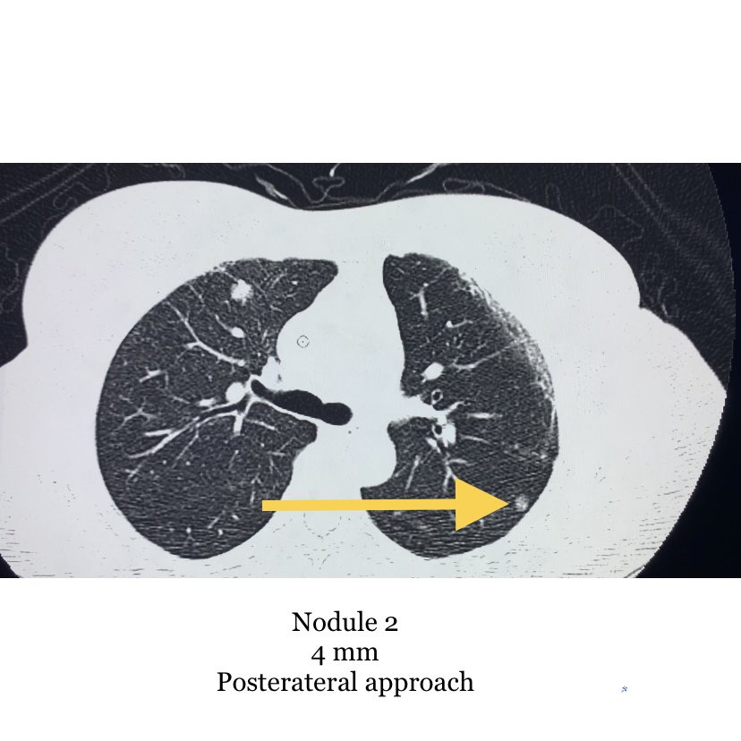 Endovascular Rounds tweet media